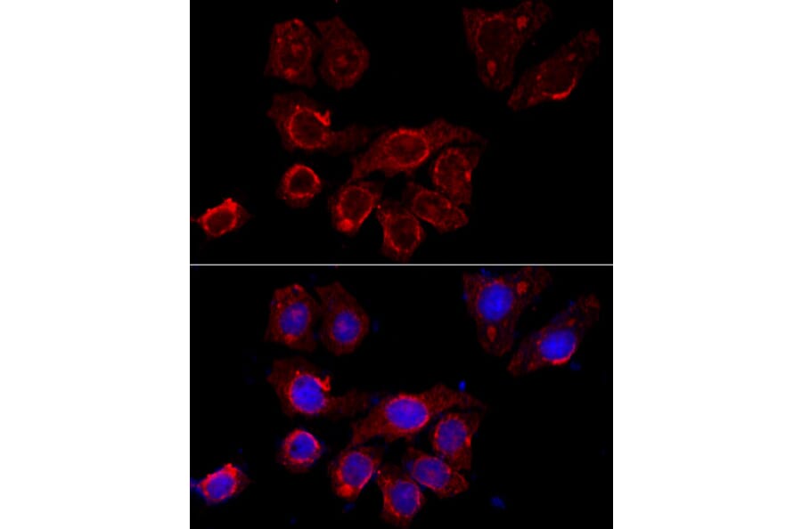 Immunofluorescence - Anti-CD116 Antibody (A11617) - Antibodies.com