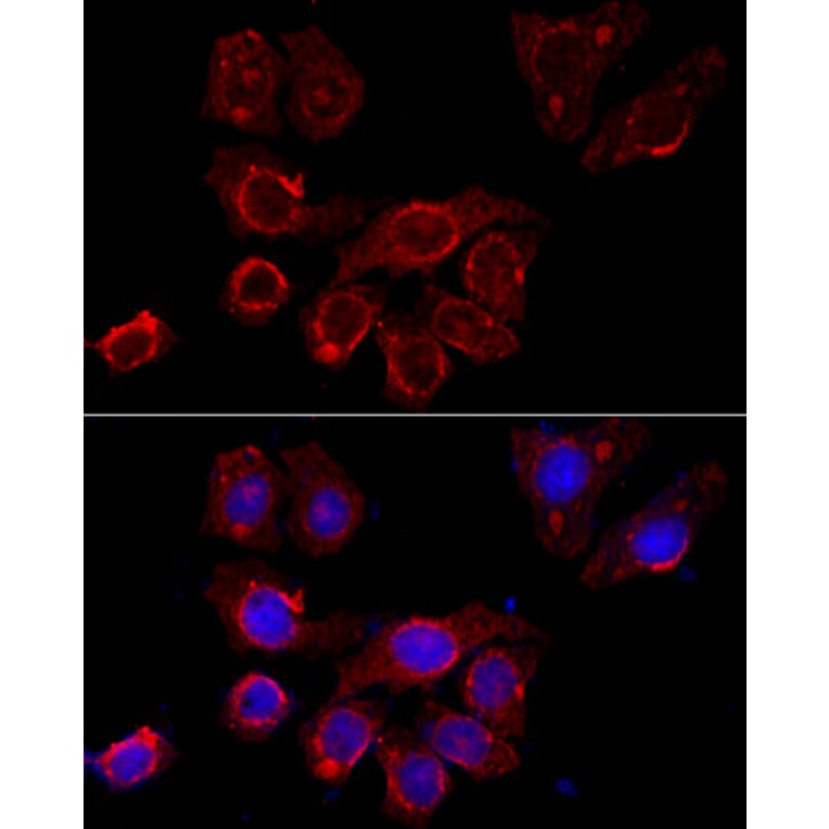 Immunofluorescence - Anti-CD116 Antibody (A11617) - Antibodies.com