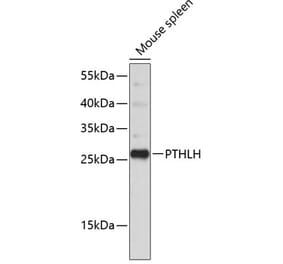 Western Blot - Anti-PTHLH Antibody (A11619) - Antibodies.com