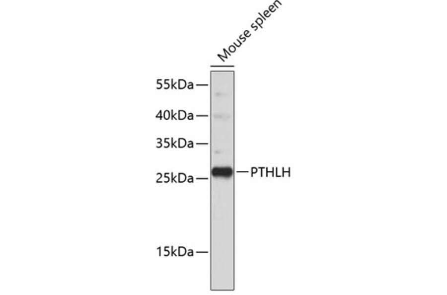 Western Blot - Anti-PTHLH Antibody (A11619) - Antibodies.com