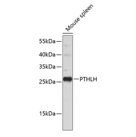 Western Blot - Anti-PTHLH Antibody (A11619) - Antibodies.com