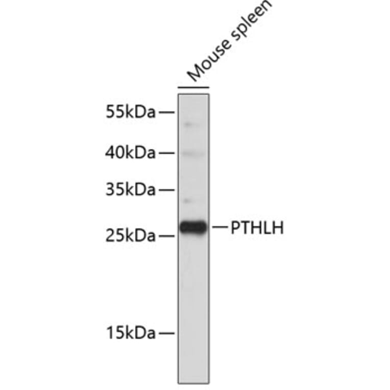 Western Blot - Anti-PTHLH Antibody (A11619) - Antibodies.com