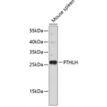 Western Blot - Anti-PTHLH Antibody (A11619) - Antibodies.com