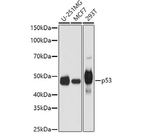 Western Blot - Anti-p53 Antibody (A11620) - Antibodies.com