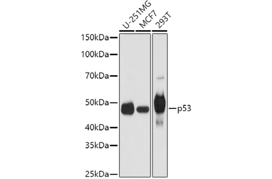 Western Blot - Anti-p53 Antibody (A11620) - Antibodies.com