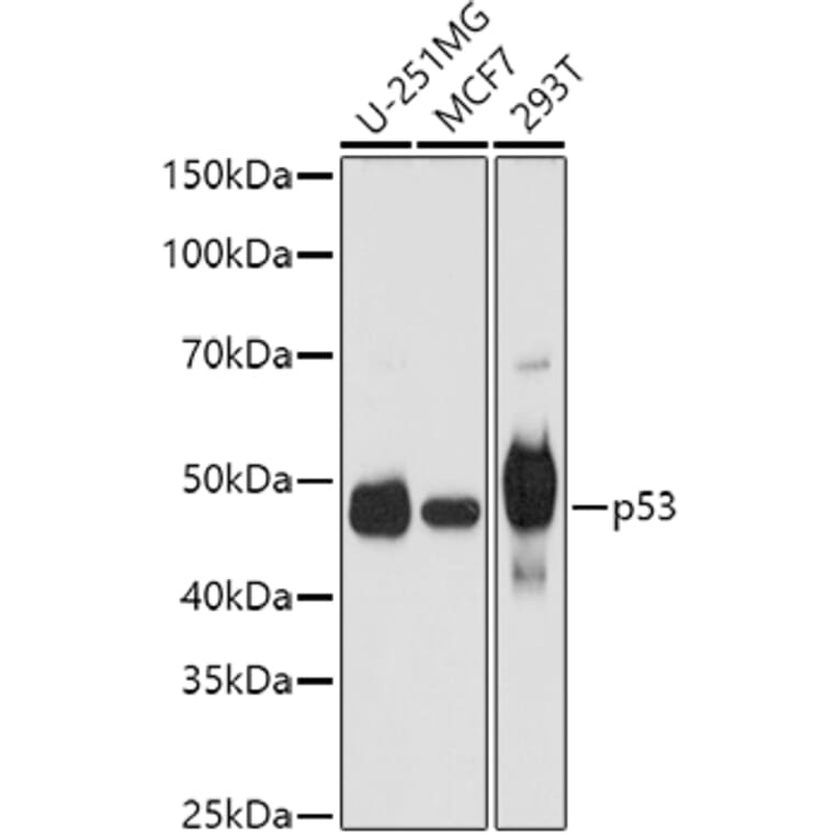 Western Blot - Anti-p53 Antibody (A11620) - Antibodies.com