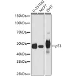 Western Blot - Anti-p53 Antibody (A11620) - Antibodies.com