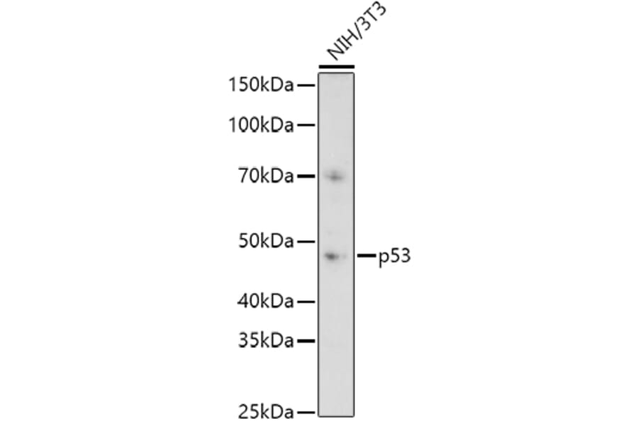 Western Blot - Anti-p53 Antibody (A11620) - Antibodies.com