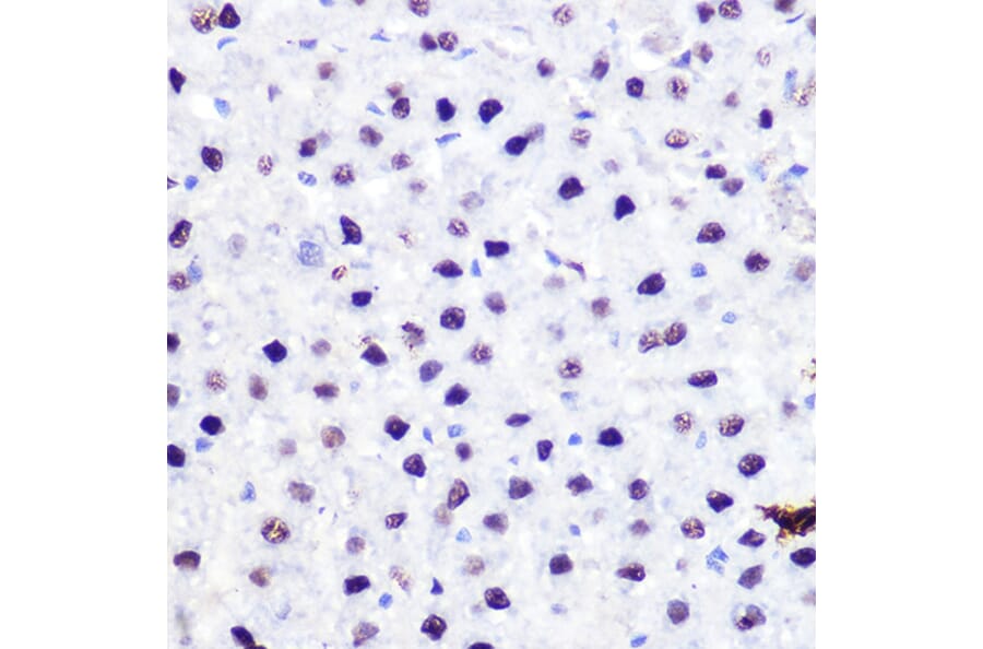 Immunohistochemistry - Anti-p53 Antibody (A11620) - Antibodies.com