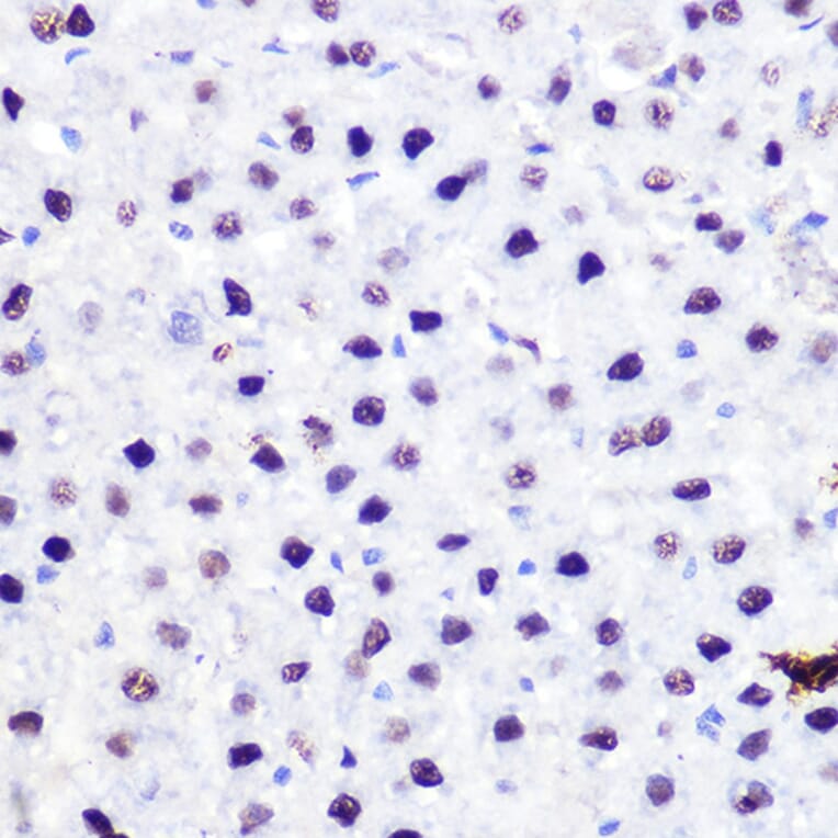 Immunohistochemistry - Anti-p53 Antibody (A11620) - Antibodies.com