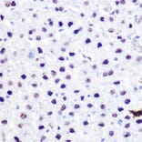 Immunohistochemistry - Anti-p53 Antibody (A11620) - Antibodies.com