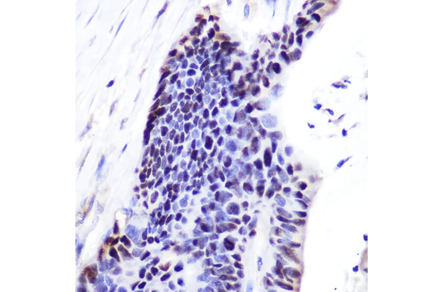 Immunohistochemistry - Anti-p53 Antibody (A11620) - Antibodies.com