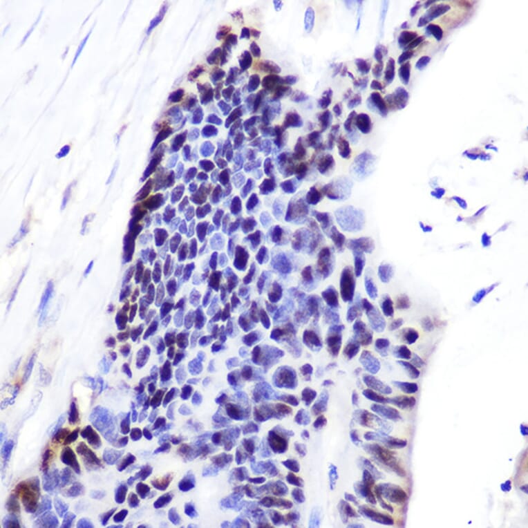 Immunohistochemistry - Anti-p53 Antibody (A11620) - Antibodies.com