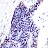 Immunohistochemistry - Anti-p53 Antibody (A11620) - Antibodies.com