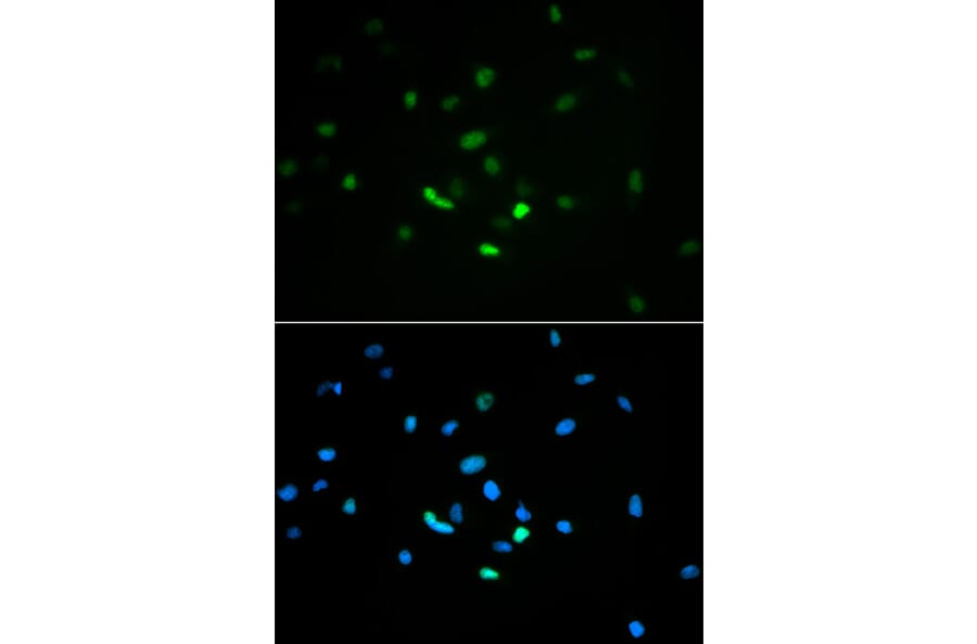 Immunofluorescence - Anti-p53 Antibody (A11620) - Antibodies.com