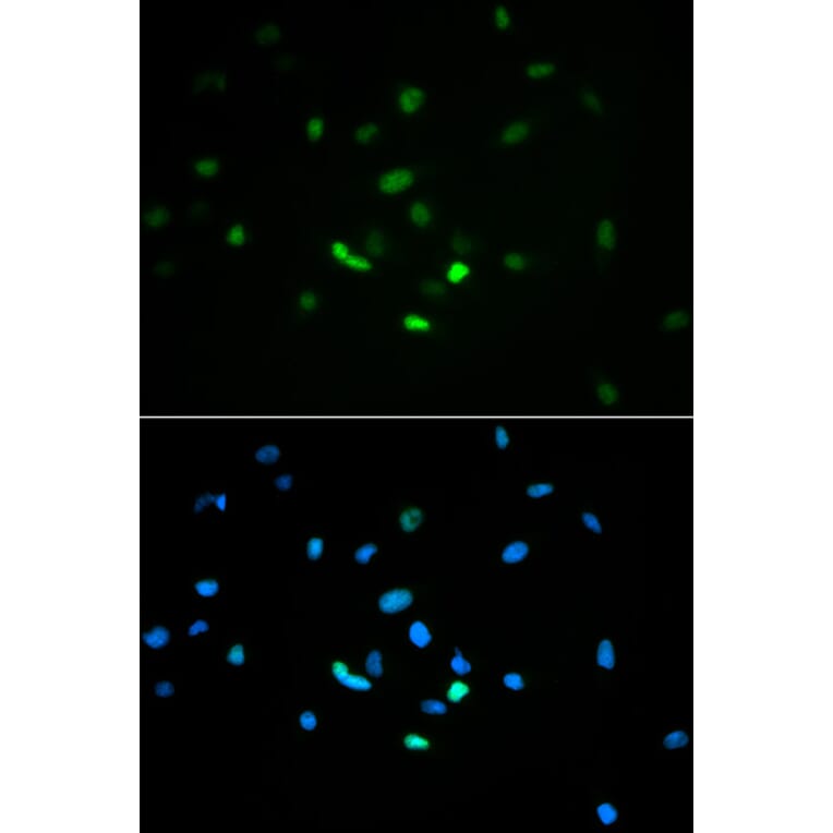 Immunofluorescence - Anti-p53 Antibody (A11620) - Antibodies.com