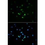Immunofluorescence - Anti-p53 Antibody (A11620) - Antibodies.com