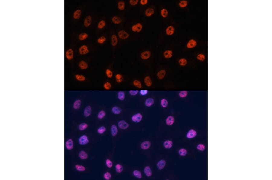 Immunofluorescence - Anti-p53 Antibody (A11620) - Antibodies.com