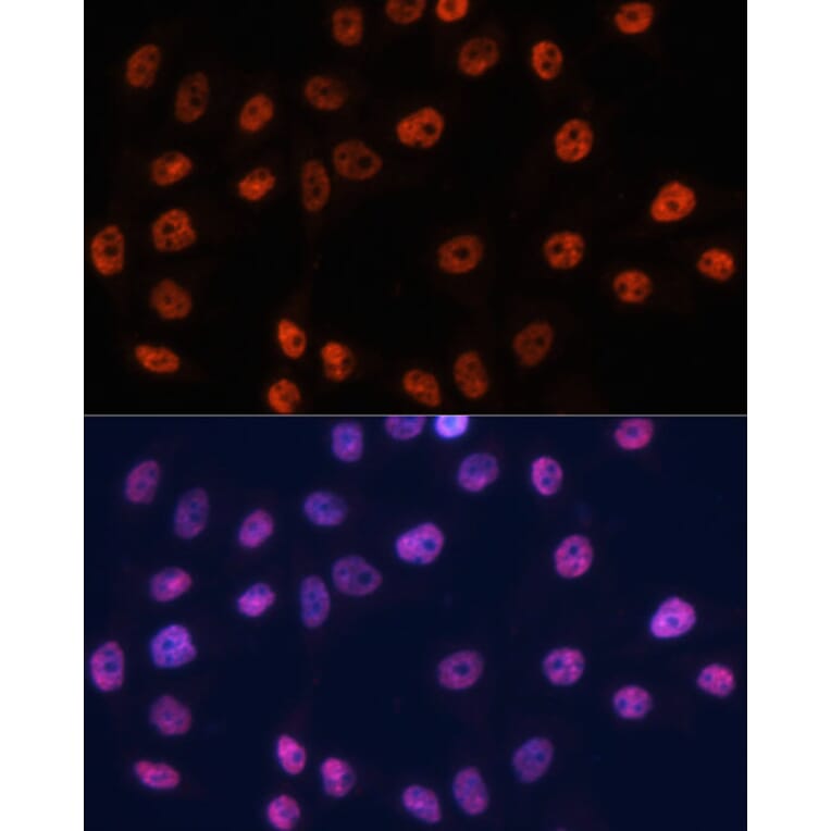 Immunofluorescence - Anti-p53 Antibody (A11620) - Antibodies.com