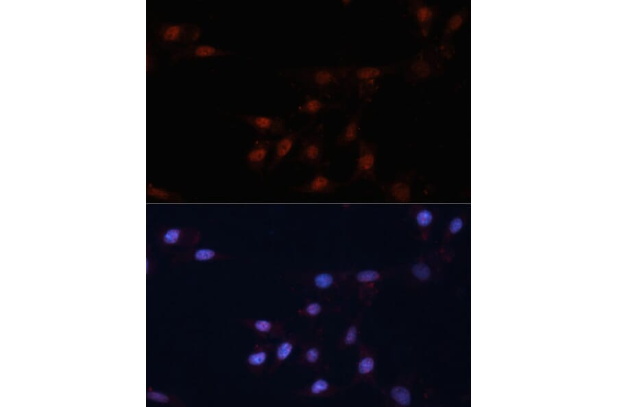 Immunofluorescence - Anti-p53 Antibody (A11620) - Antibodies.com