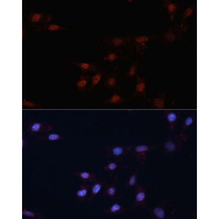 Immunofluorescence - Anti-p53 Antibody (A11620) - Antibodies.com
