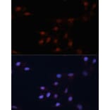 Immunofluorescence - Anti-p53 Antibody (A11620) - Antibodies.com