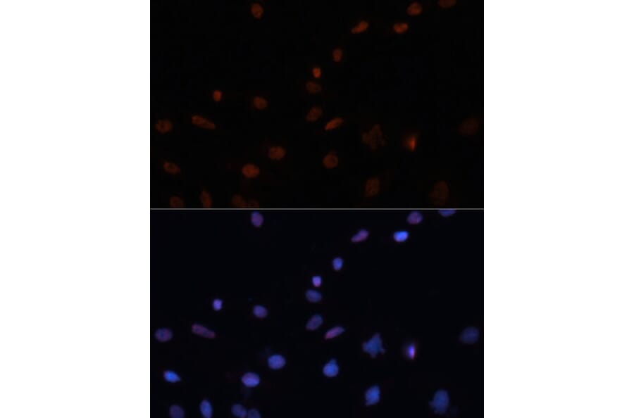 Immunofluorescence - Anti-p53 Antibody (A11620) - Antibodies.com