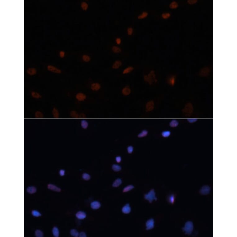 Immunofluorescence - Anti-p53 Antibody (A11620) - Antibodies.com