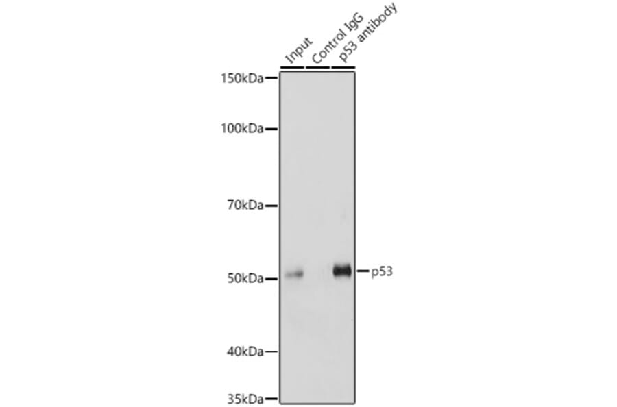 Western Blot - Anti-p53 Antibody (A11620) - Antibodies.com
