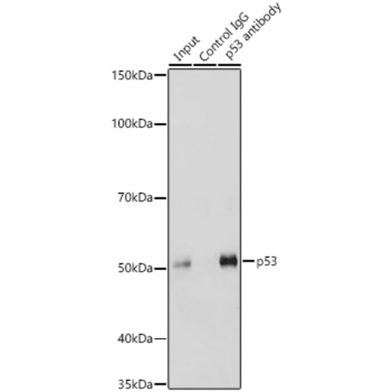 Western Blot - Anti-p53 Antibody (A11620) - Antibodies.com