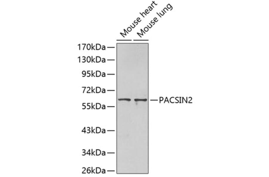 Western Blot - Anti-PACSIN2 Antibody (A3197) - Antibodies.com