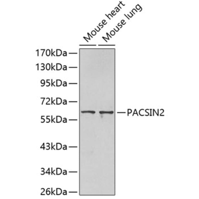 Western Blot - Anti-PACSIN2 Antibody (A3197) - Antibodies.com