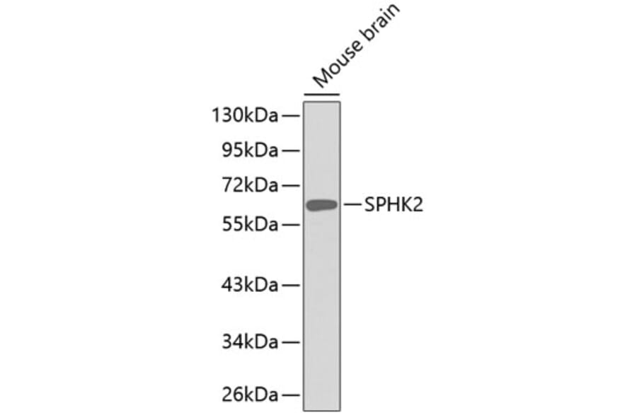 Western Blot - Anti-SPHK2 Antibody (A11622) - Antibodies.com