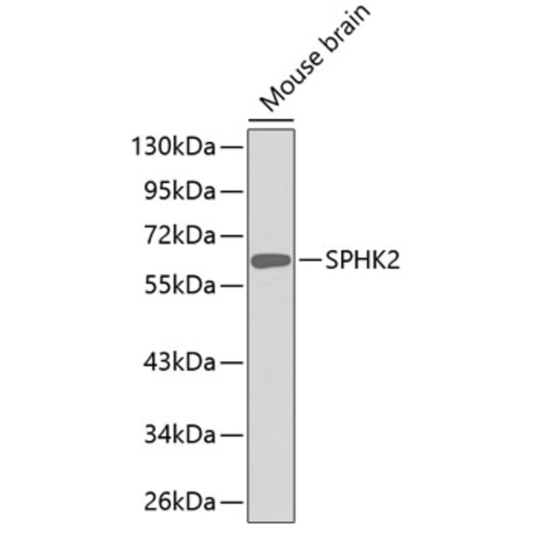 Western Blot - Anti-SPHK2 Antibody (A11622) - Antibodies.com