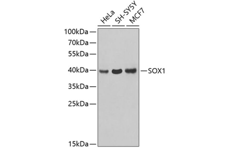 Western Blot - Anti-SOX1 Antibody (A3222) - Antibodies.com