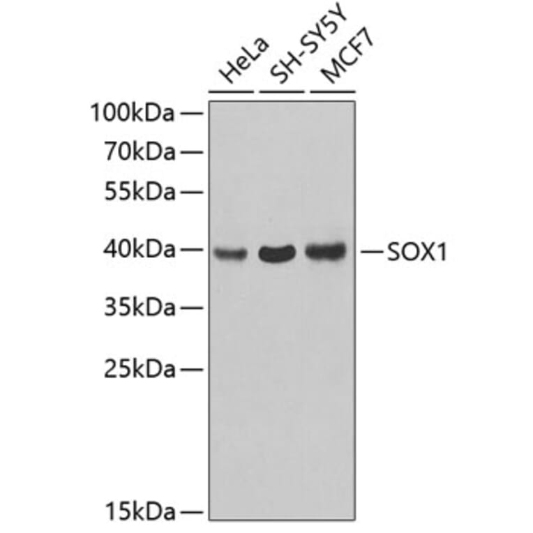 Western Blot - Anti-SOX1 Antibody (A3222) - Antibodies.com