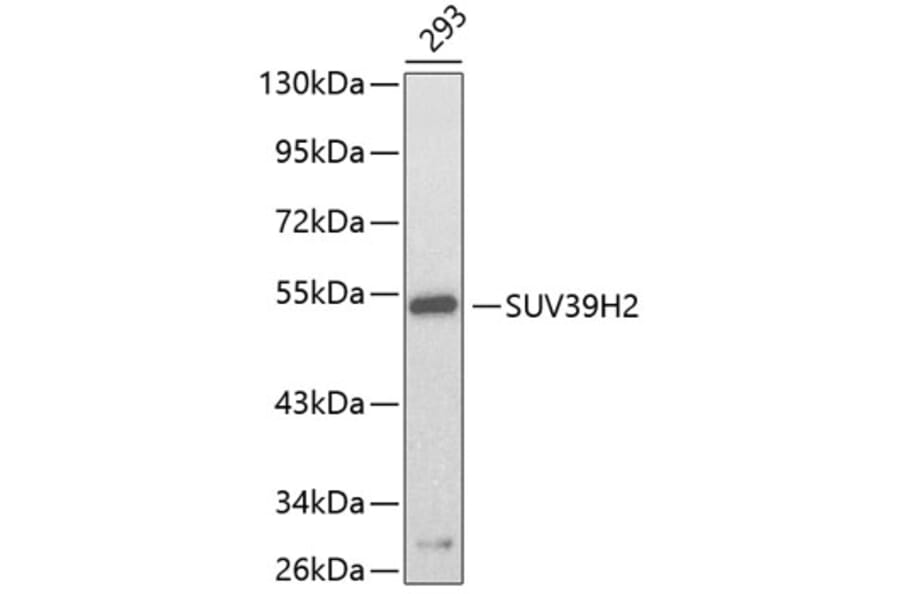 Western Blot - Anti-SUV39H2 Antibody (A3227) - Antibodies.com