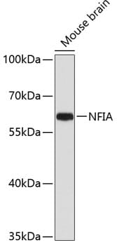 Western blot analysis of extracts of mouse brain, using Anti-NFIA Antibody (A3258) at 1:1,000 dilution.
Secondary antibody: Goat Anti-Rabbit IgG (H+L) (HRP) (AS014) at 1:10,000 dilution.
Lysates / proteins: 25µg per lane.
Blocking buffer: 3% non-fat dry milk in TBST.
Detection: ECL Basic Kit (RM00020).
Exposure time: 60s.