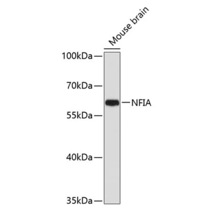 Western Blot - Anti-Nuclear Factor 1 Antibody (A11626) - Antibodies.com