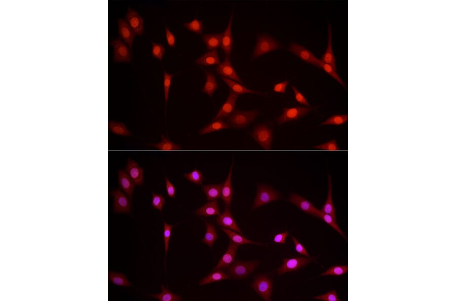 Immunofluorescence - Anti-Nuclear Factor 1 Antibody (A11626) - Antibodies.com