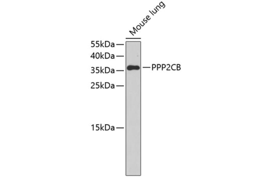 Western Blot - Anti-PPP2CB Antibody (A3275) - Antibodies.com