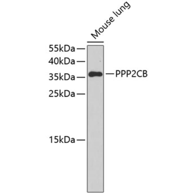Western Blot - Anti-PPP2CB Antibody (A3275) - Antibodies.com