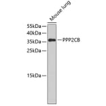 Western Blot - Anti-PPP2CB Antibody (A3275) - Antibodies.com