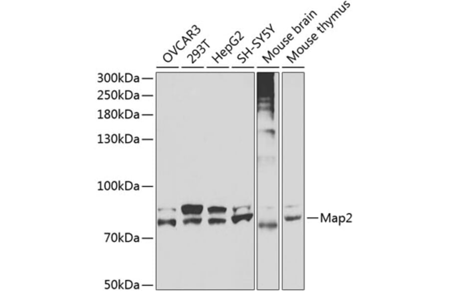 Western Blot - Anti-Map2 Antibody (A3278) - Antibodies.com