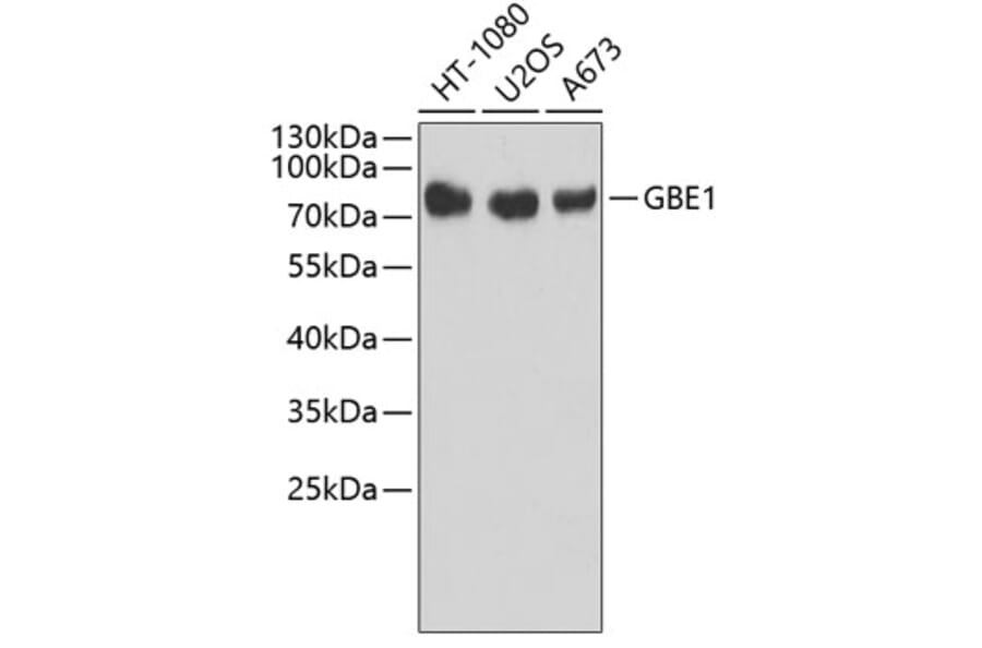 Western Blot - Anti-GBE1 Antibody (A3296) - Antibodies.com