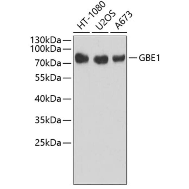 Western Blot - Anti-GBE1 Antibody (A3296) - Antibodies.com