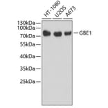 Western Blot - Anti-GBE1 Antibody (A3296) - Antibodies.com