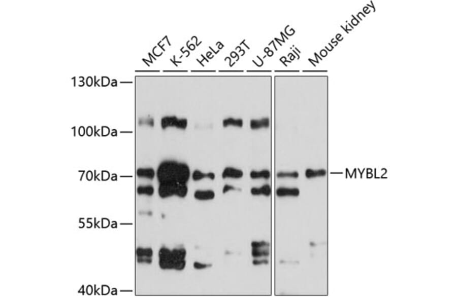Western Blot - Anti-MYBL2 Antibody (A3310) - Antibodies.com