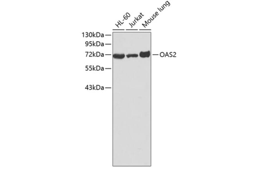 Western Blot - Anti-OAS2 Antibody (A3316) - Antibodies.com