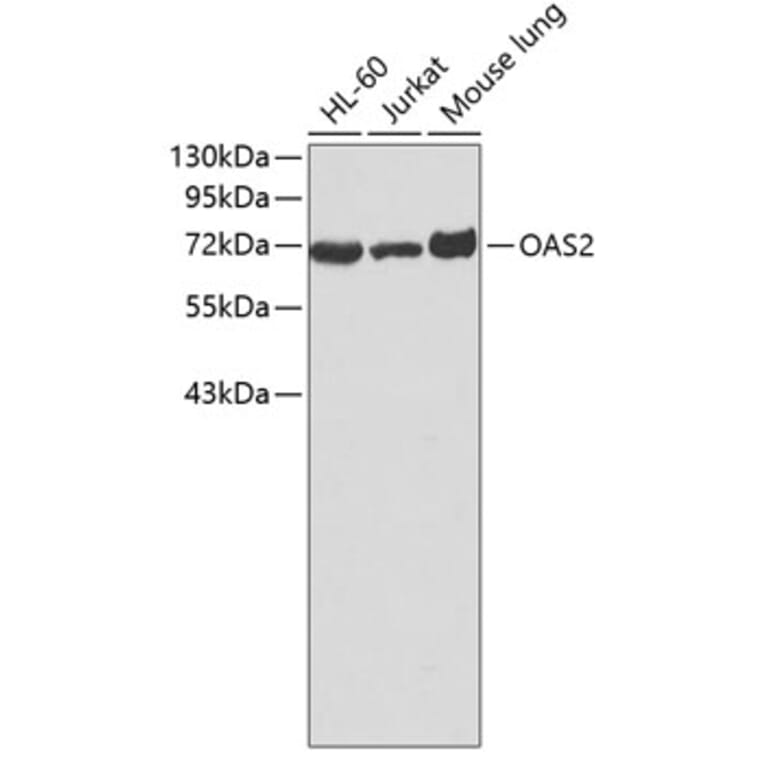 Western Blot - Anti-OAS2 Antibody (A3316) - Antibodies.com